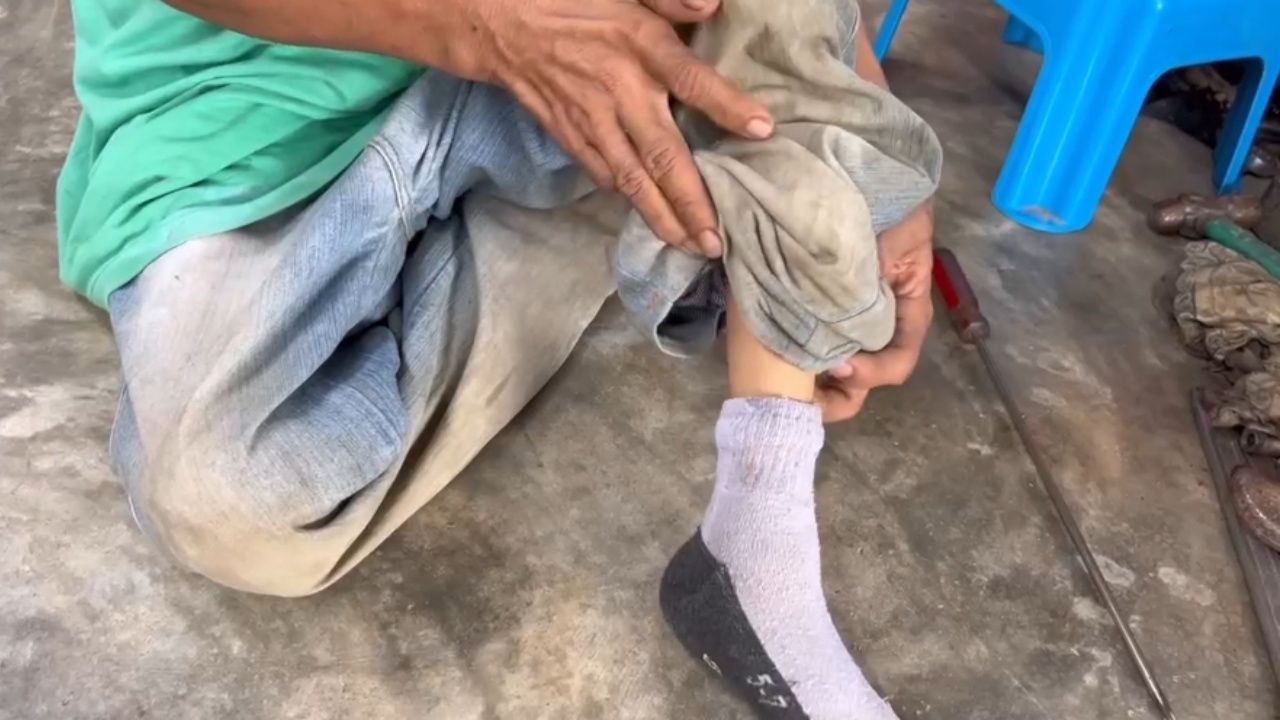 截肢男士积极生活 开设摩托车维修店和出售植物以谋生