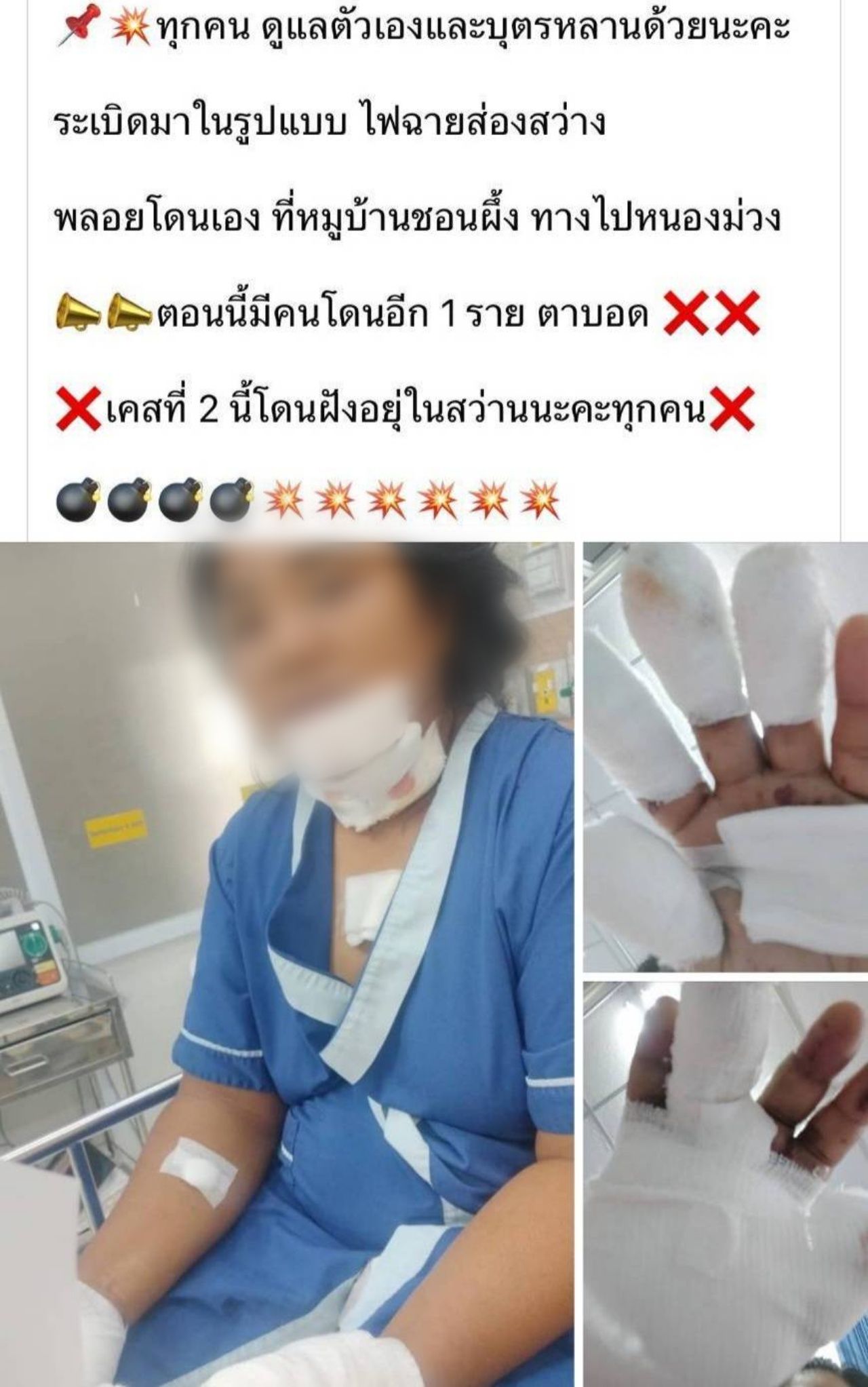 警告：村民捡到路边物品后被爆炸严重受伤，2人截指-失明