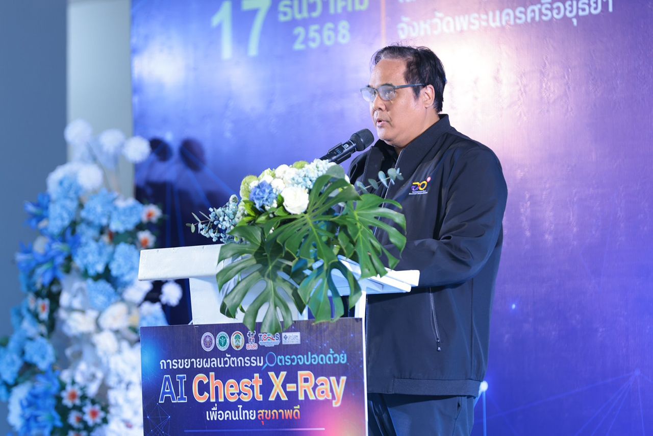 高等教育、科学、研究与创新部与卫生部合作推出AI胸部X光筛查肺病，免费服务让泰国人民健康