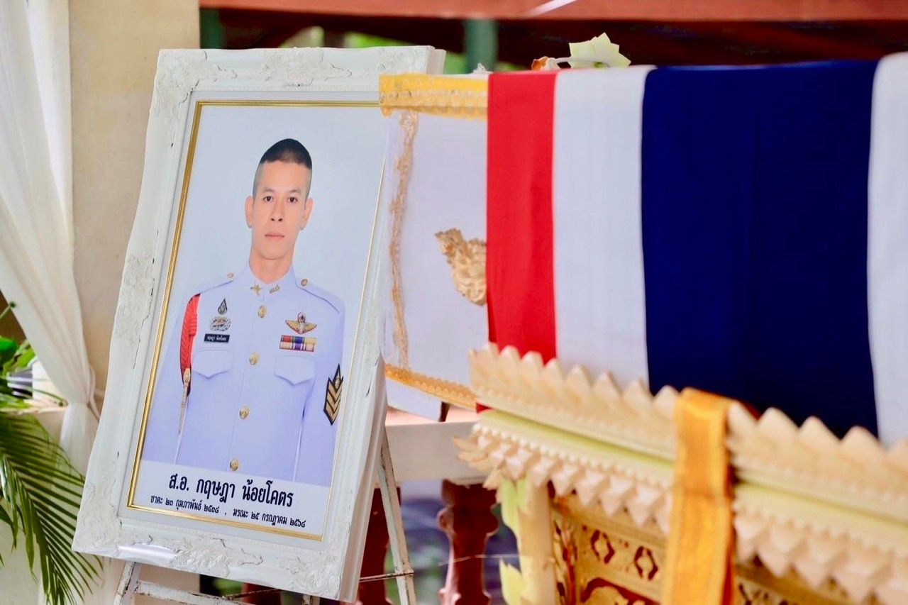 国王陛下仁慈地赐予因受伤截肢的士兵全球最佳的义肢
