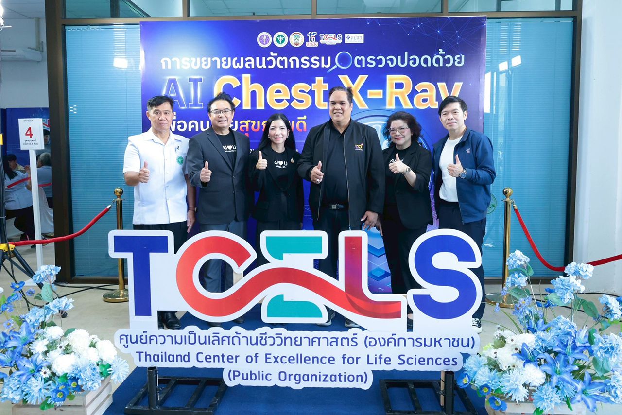 高等教育、科学、研究与创新部与卫生部合作推出AI胸部X光筛查肺病，免费服务让泰国人民健康